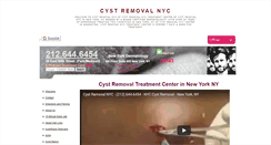 Desktop Screenshot of cystremovalnyc.net