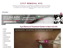 Tablet Screenshot of cystremovalnyc.net