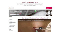 Desktop Screenshot of cystremovalnyc.com