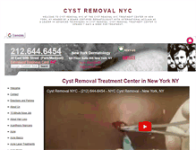 Tablet Screenshot of cystremovalnyc.com